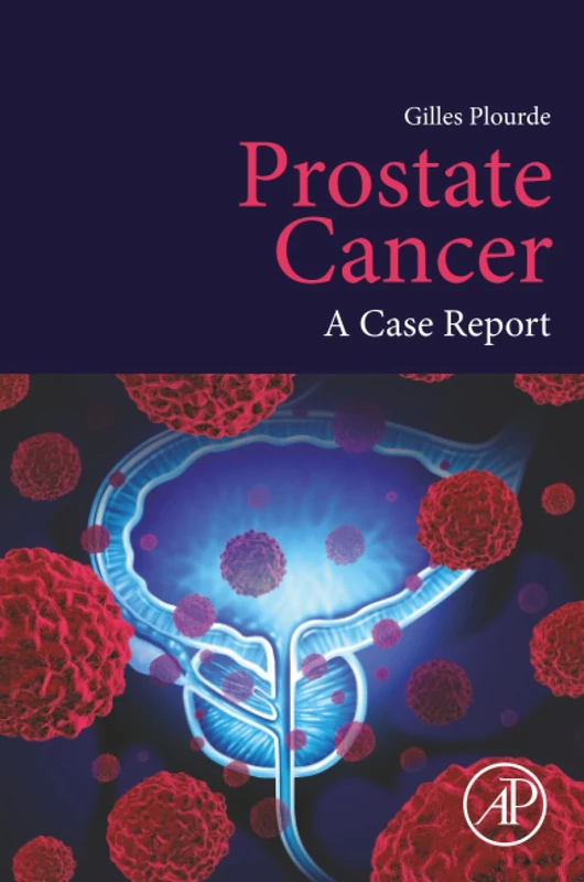 Prostate Cancer: A Case Report