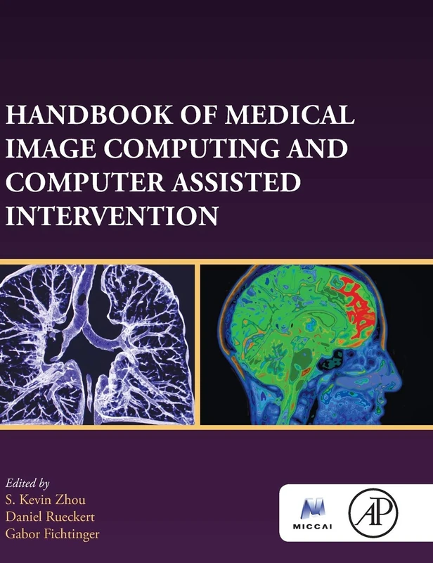 Handbook of Medical Image Computing and Computer Assisted Intervention (The MICCAI Society book Series)