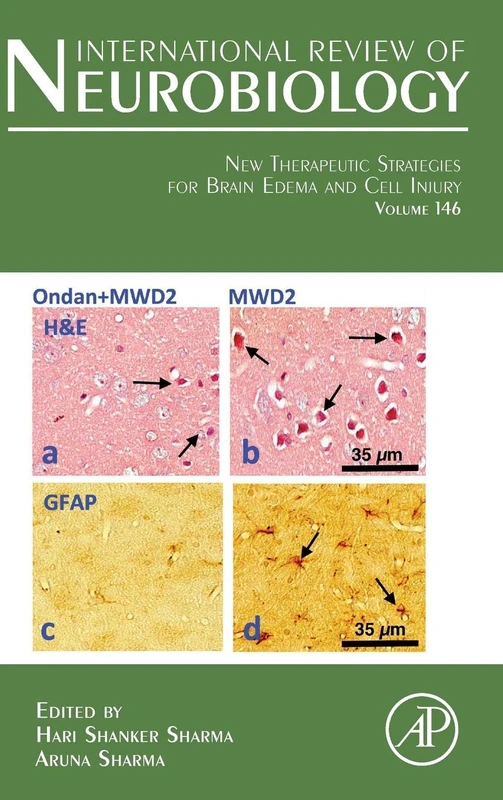New Therapeutic Strategies for Brain Edema and Cell Injury (Volume 146) (International Review of Neurobiology, Volume 146)