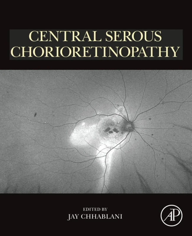 Central Serous Chorioretinopathy