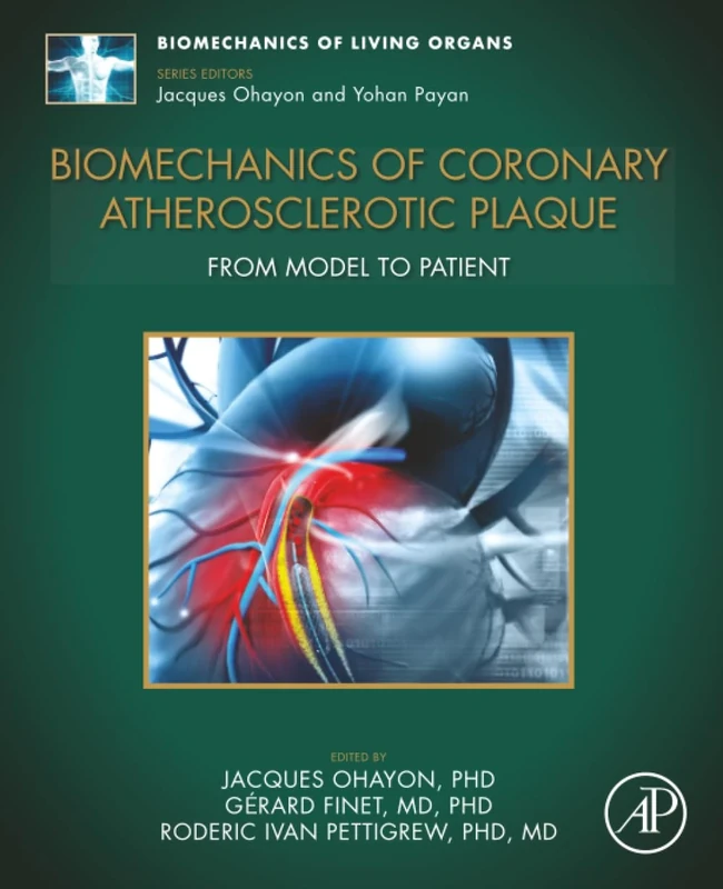 Biomechanics of Coronary Atherosclerotic Plaque: From Model to Patient: Volume 4 (Biomechanics of Living Organs, Volume 4)