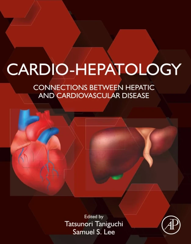Cardio-Hepatology: Connections Between Hepatic and Cardiovascular Disease