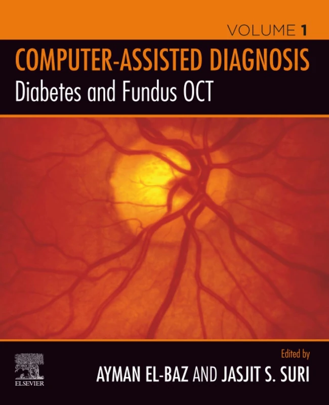 Diabetes and Fundus OCT (Computer-Assisted Diagnosis)