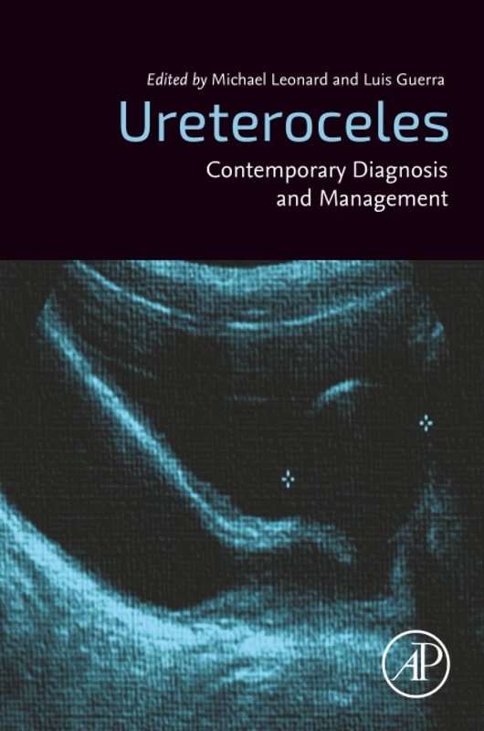 Ureteroceles: Contemporary Diagnosis and Management