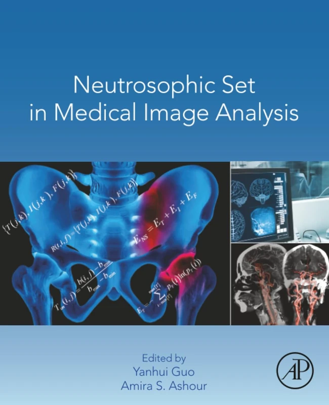 Neutrosophic Set in Medical Image Analysis - Academic Press
