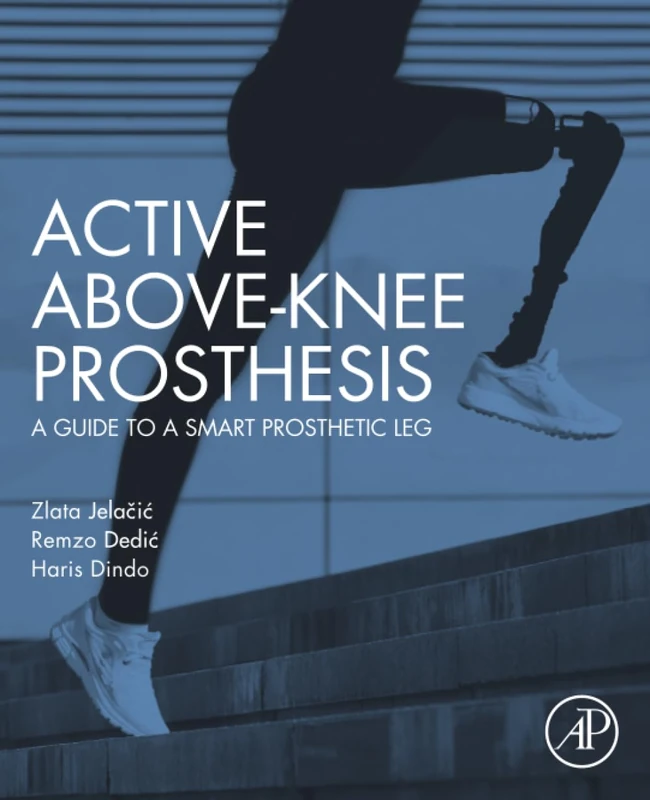 Active Above-Knee Prosthesis: A Guide to a Smart Prosthetic Leg