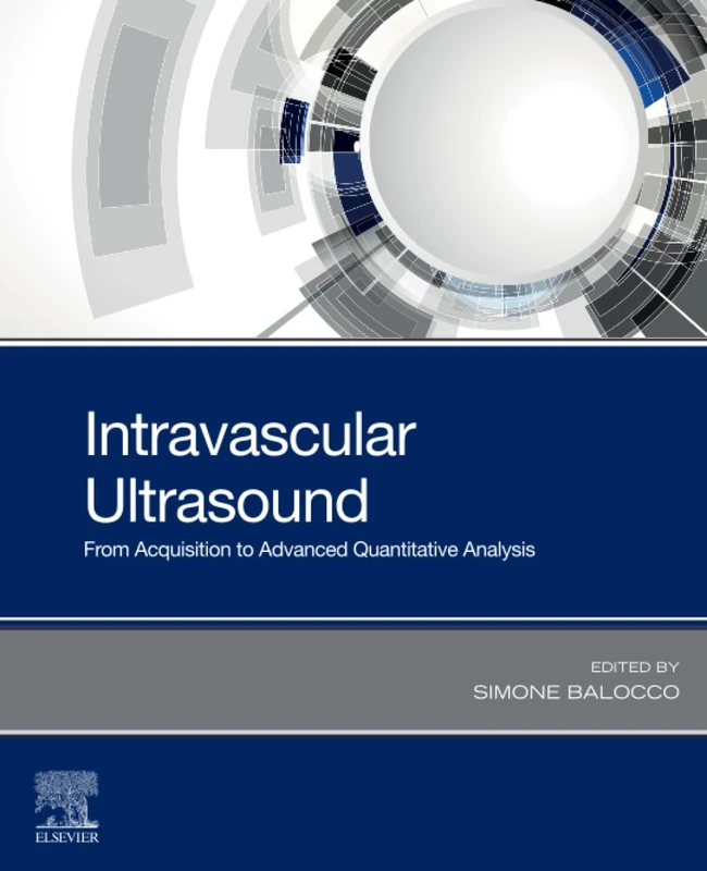 Intravascular Ultrasound: From Acquisition to Advanced Quantitative Analysis