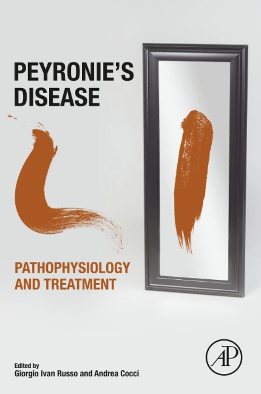 Academic Press - Peyronie's Disease: Pathophysiology and Treatment