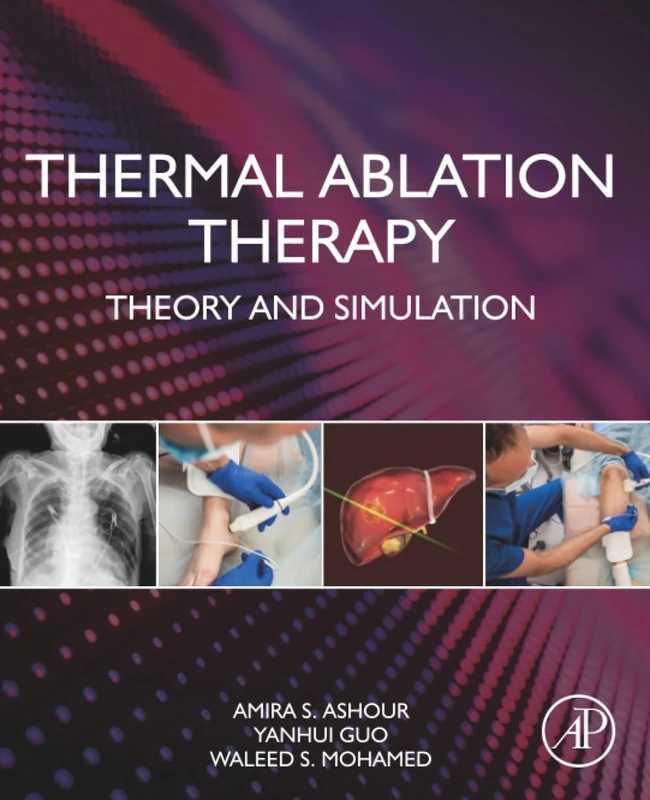 Thermal Ablation Therapy: Theory and Simulation - Image 1