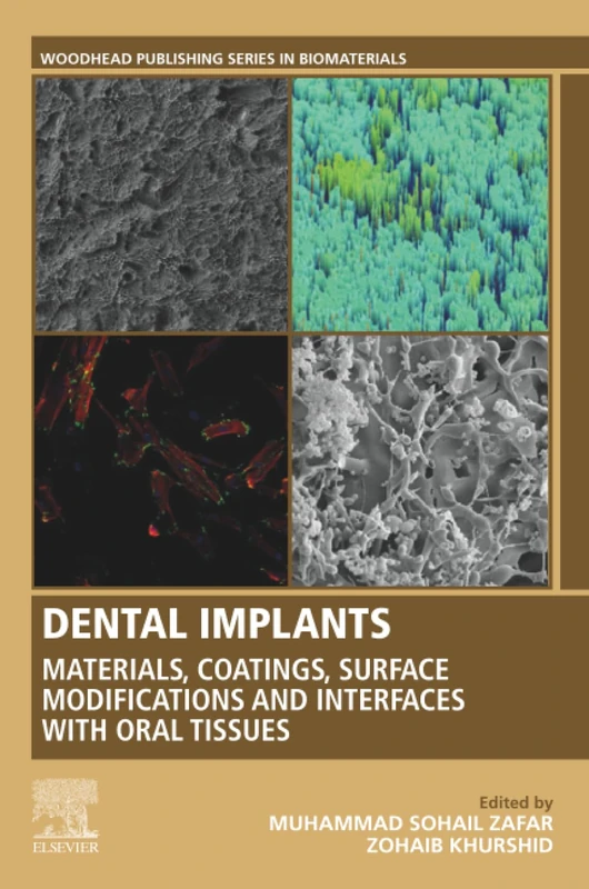 Dental Implants: Materials, Coatings, Surface Modifications and Interfaces with Oral Tissues (Woodhead Publishing Series in Biomaterials)