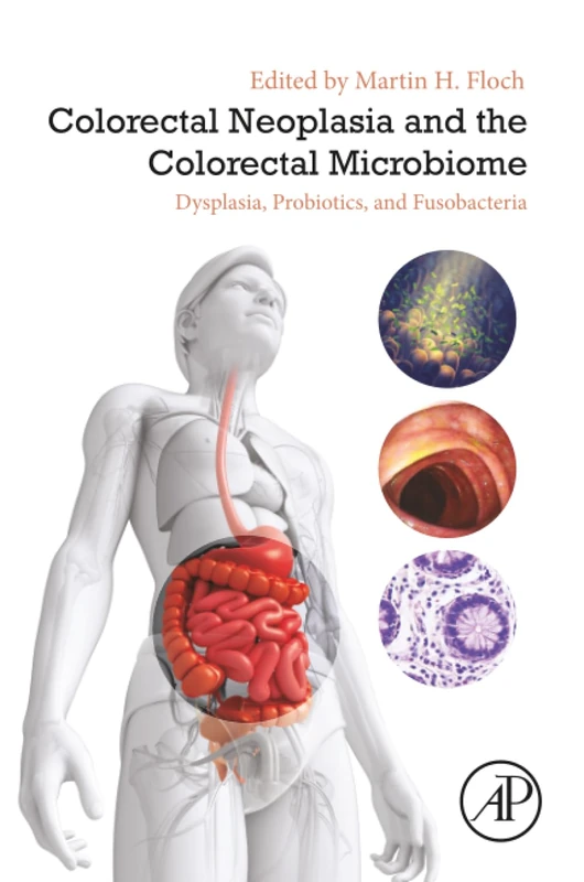 Academic Press - Colorectal Neoplasia and the Microbiome Book