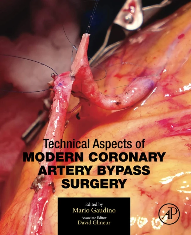 Technical Aspects of Modern Coronary Artery Bypass Surgery - Image 1
