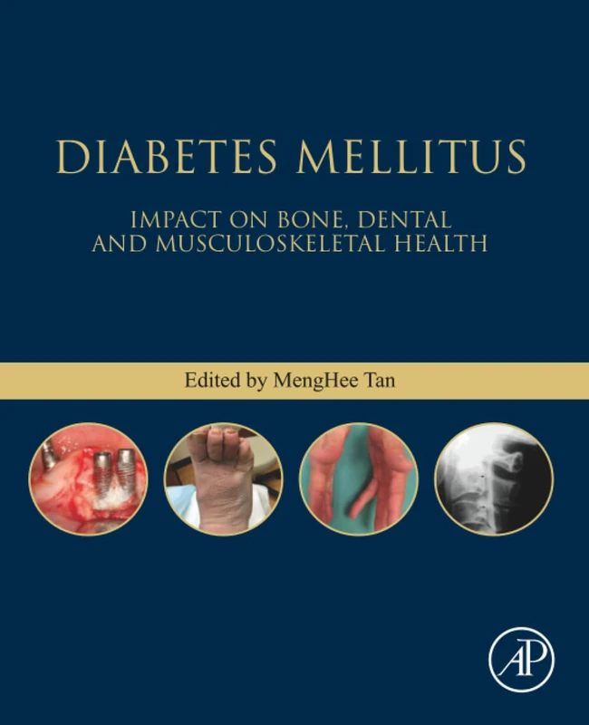 Academic Press - Diabetes Mellitus: Bone and Musculoskeletal Health