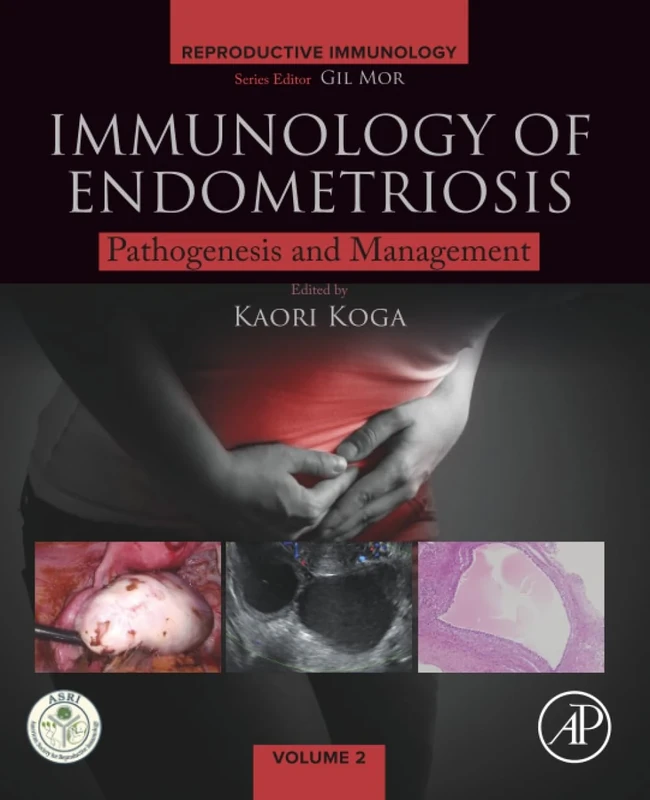 Immunology of Endometriosis: Pathogenesis and Management (Reproductive Immunology)