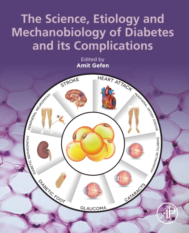 The Science, Etiology and Mechanobiology of Diabetes and its Complications