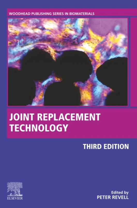 Joint Replacement Technology (Woodhead Publishing Series in Biomaterials)