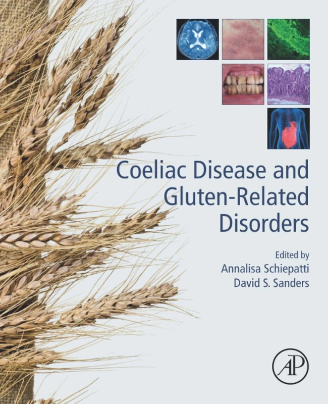 Academic Press - Coeliac Disease and Gluten-Related Disorders