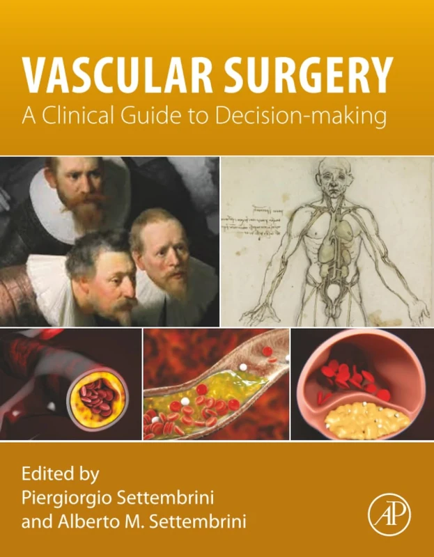 Vascular Surgery: A Clinical Guide to Decision-making