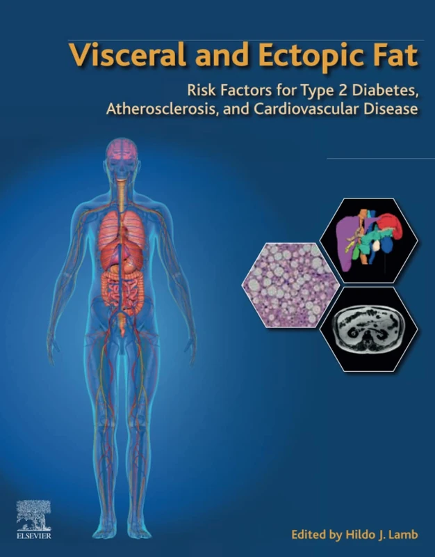 Elsevier Visceral and Ectopic Fat - Medical Reference Book