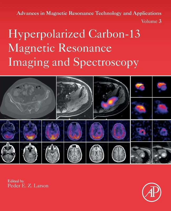 Hyperpolarized Carbon-13 Magnetic Resonance Imaging and Spectroscopy: Volume 3 (Advances in Magnetic Resonance Technology and Applications, Volume 3)