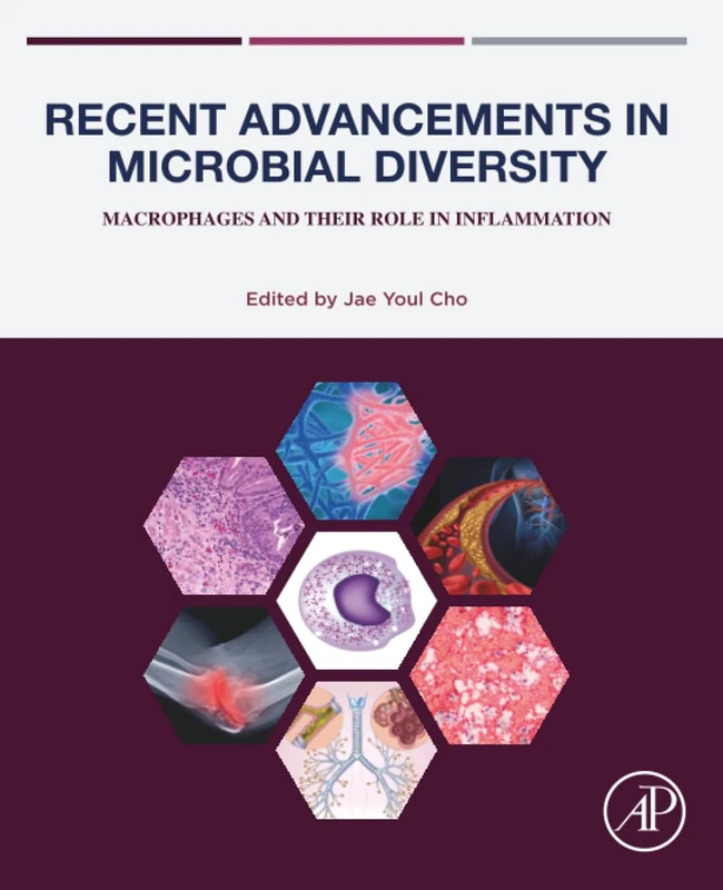 Recent Advancements in Microbial Diversity: Macrophages and their Role in Inflammation (Woodhead Publishing Series in Composites Science and Engineering)