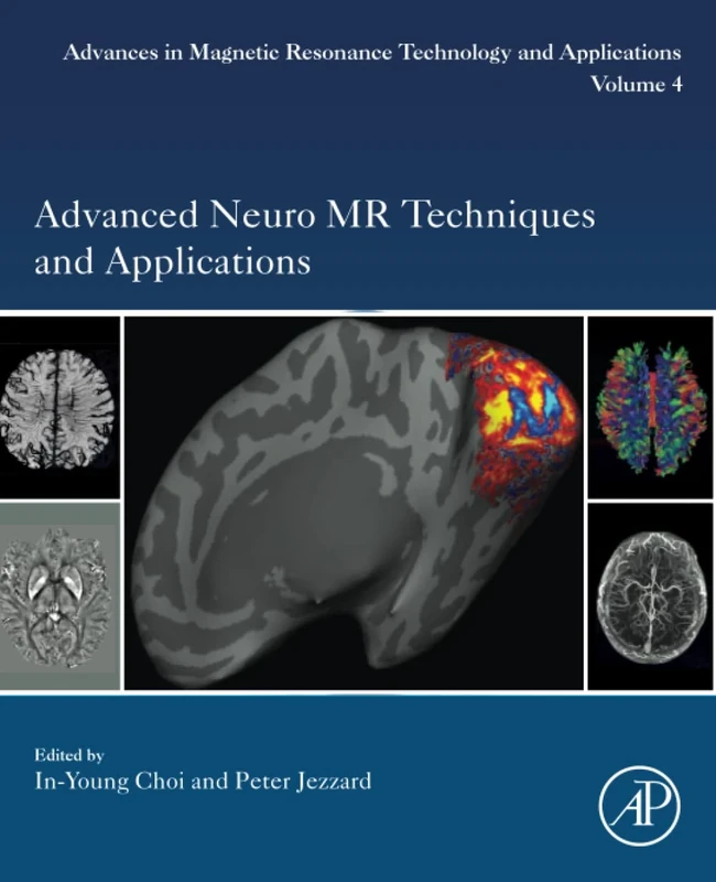 Advanced Neuro MR Techniques and Applications: Volume 4 (Advances in Magnetic Resonance Technology and Applications, Volume 4)