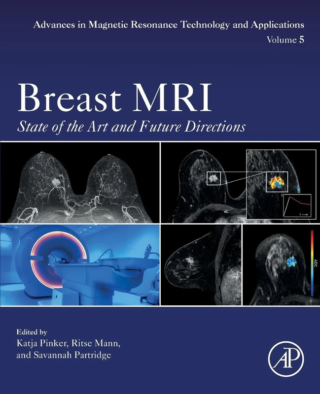 Breast MRI: State of the Art and Future Directions: Volume 5 (Advances in Magnetic Resonance Technology and Applications, Volume 5)