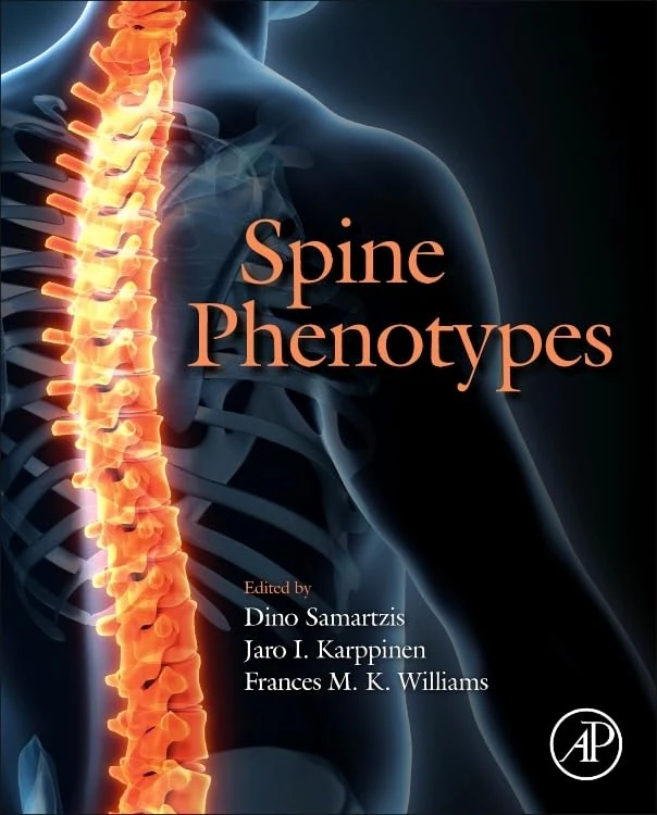 Spine Phenotypes by Academic Press - Medical Resource Book