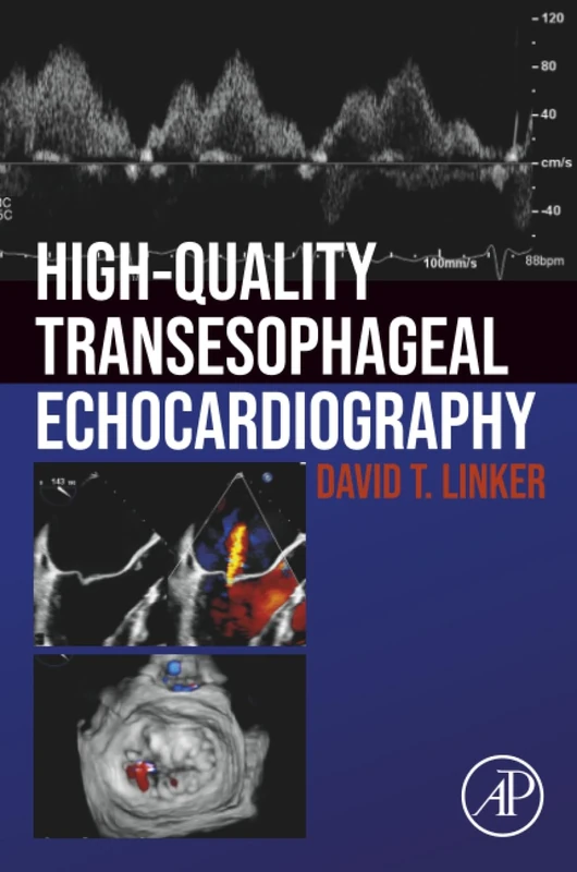 High-Quality Transesophageal Echocardiography