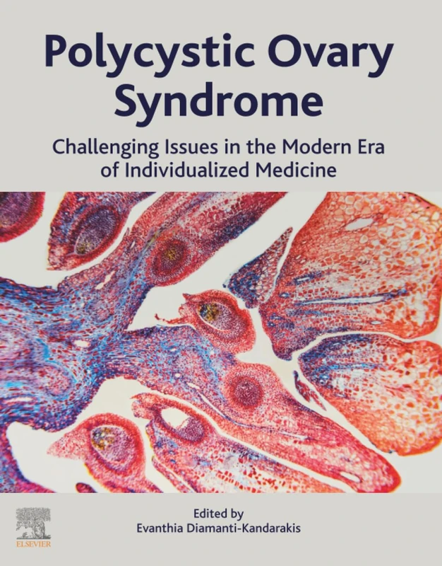 Elsevier Polycystic Ovary Syndrome Medical Textbook - Image 1