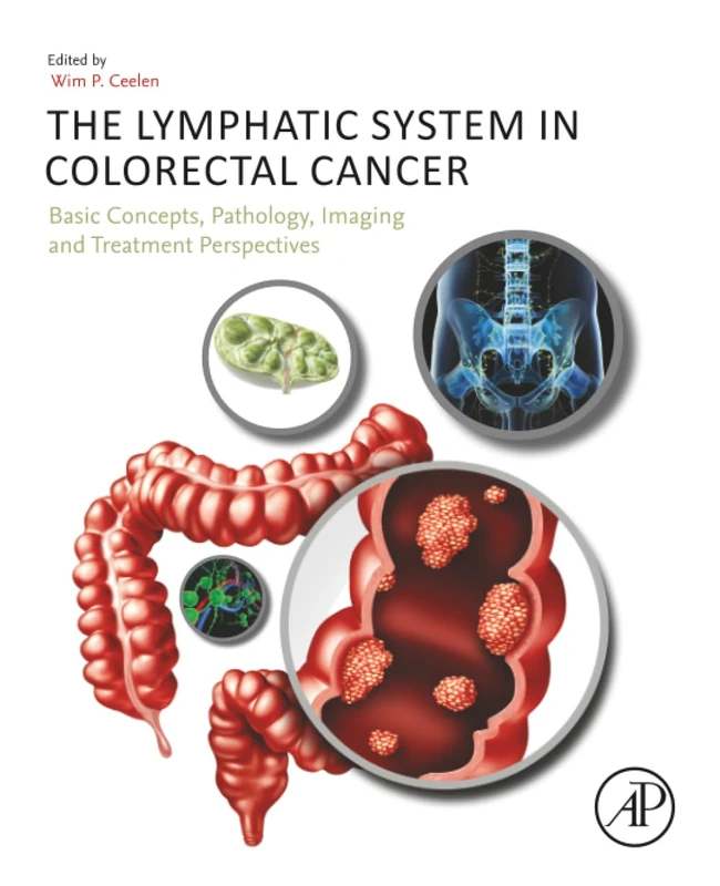 Academic Press - Lymphatic System in Colorectal Cancer Book