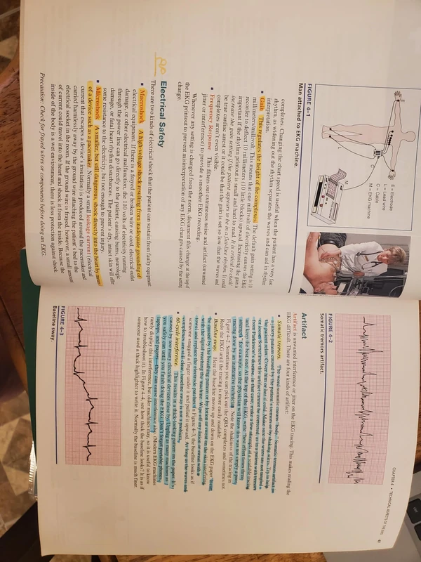 EKG Plain and Simple