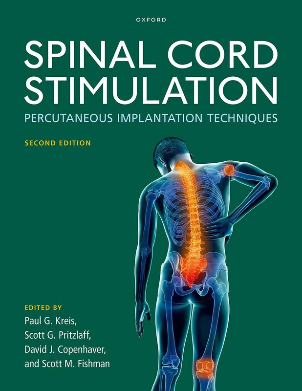 Spinal Cord Stimulation: Percutaneous Implantation Techniques