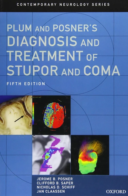 Plum and Posner's Diagnosis and Treatment of Stupor and Coma (Contemporary Neurology Series)