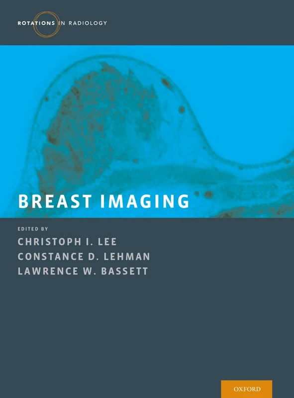 Breast Imaging (Rotations in Radiology)