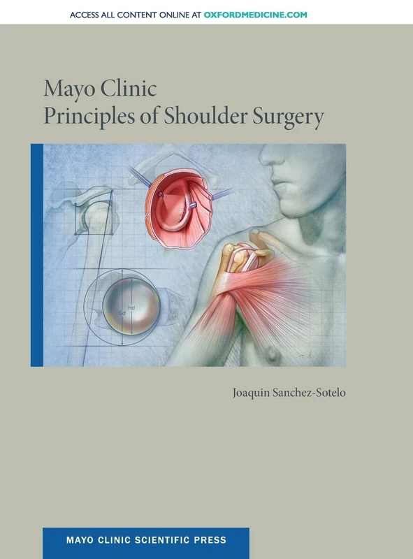 Mayo Clinic Principles of Shoulder Surgery (Mayo Clinic Scientific Press)