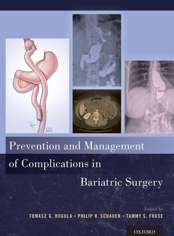 Prevention and Management of Complications in Bariatric Surgery