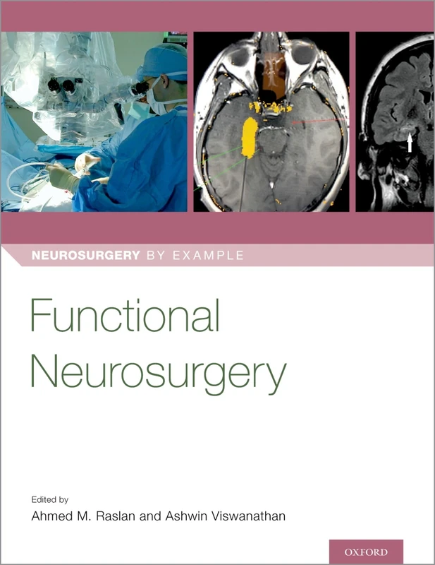 Functional Neurosurgery (Neurosurgery by Example)