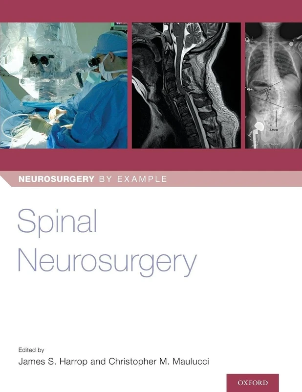 Spinal Neurosurgery (Neurosurgery by Example)