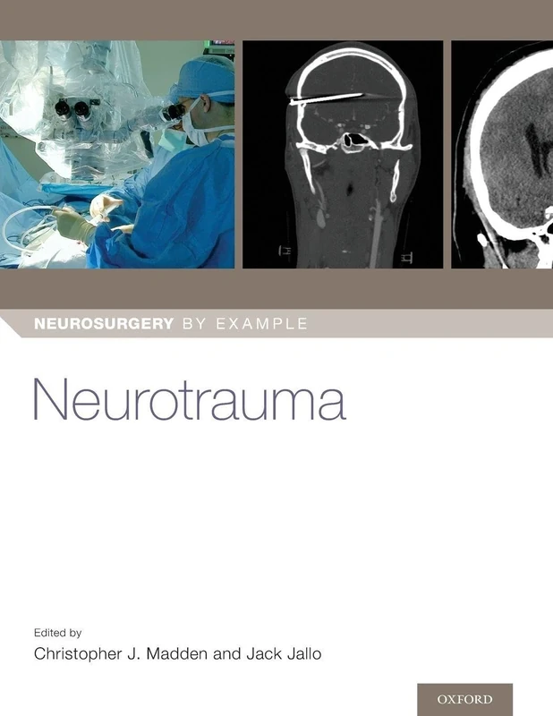 Neurotrauma (Neurosurgery by Example)