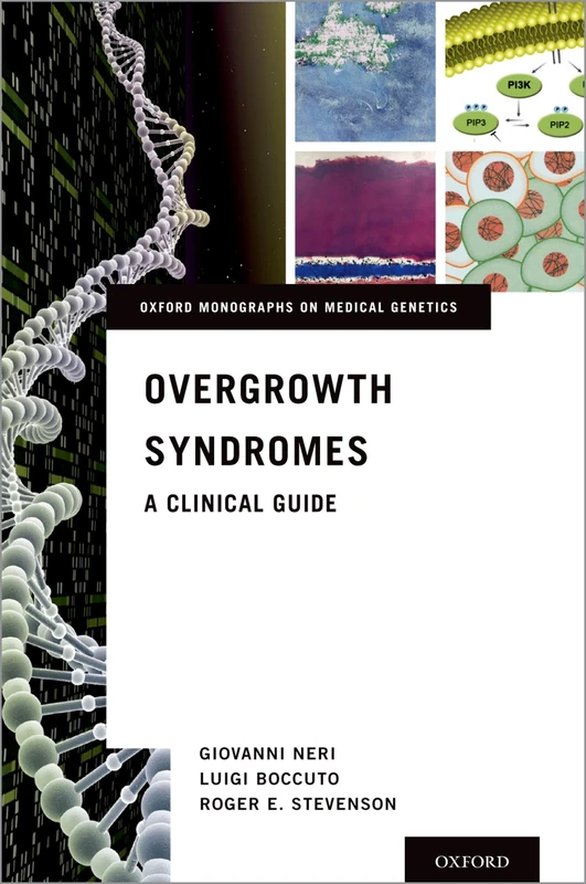 Overgrowth Syndromes: A Clinical Guide (Oxford Monographs on Medical Genetics)