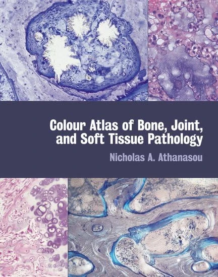 Colour Atlas of Bone, Joint and Soft Tissue Pathology
