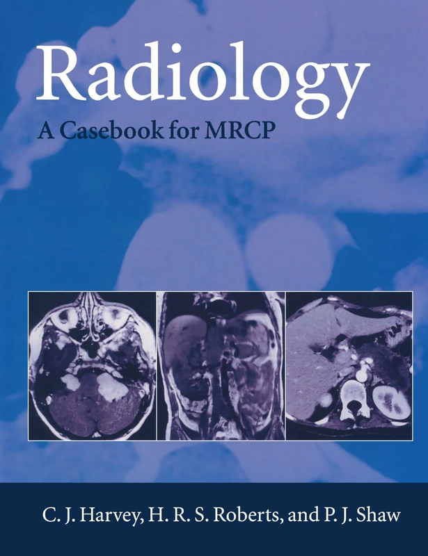 Radiology: A Casebook for M.R.C.P. (Oxford Medical Publications)