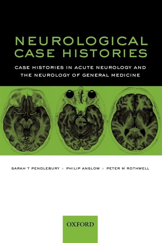 Neurological Case Histories (Oxford Case Histories): Case Histories in Acute Neurology and the Neurology of General Medicine