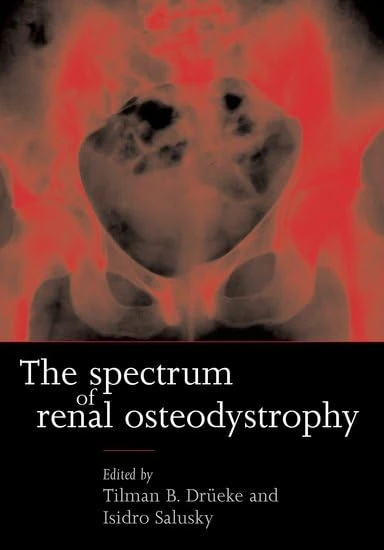 Oxford University Press - The Spectrum of Renal Osteodystrophy