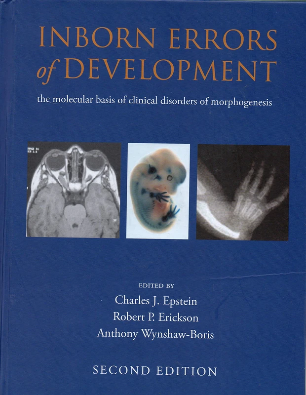 Inborn Errors of Development: The molecular basis of clinical disorders of morphogenesis: 54 (Oxford Monographs on Medical Genetics)