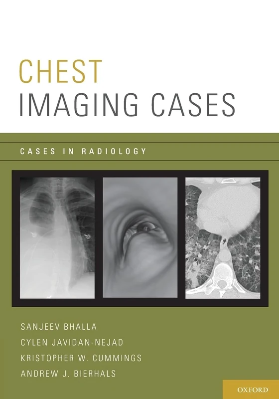 Chest Imaging Cases (Cases in Radiology)