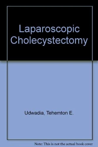 Laparoscopic Cholecystectomy
