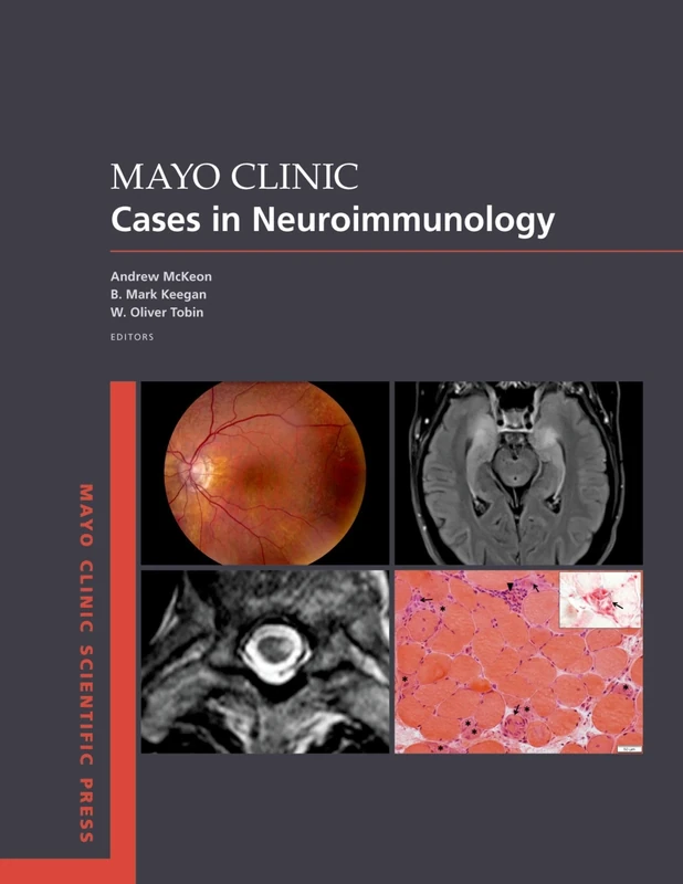 Mayo Clinic Cases in Neuroimmunology (Mayo Clinic Scientific Press)