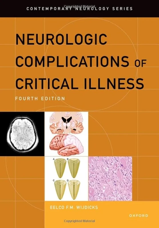 Neurologic Complications of Critical Illness (CONTEMPORARY NEUROLOGY SERIES)